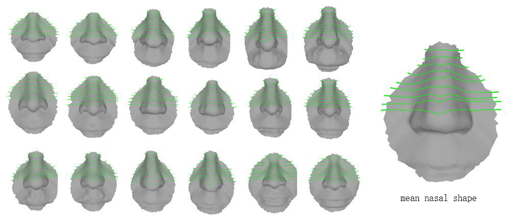 Nasal similarity measure of 3D faces based on curve shape space.